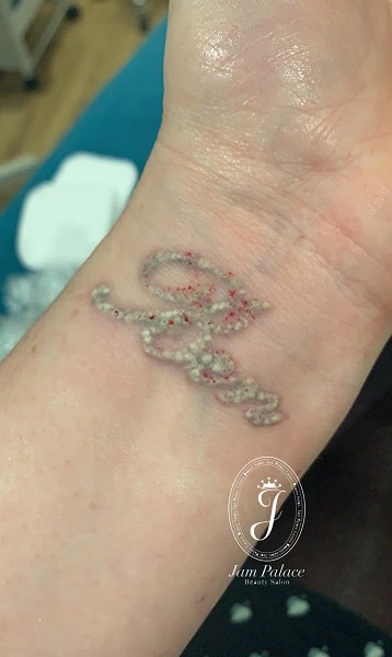 ریموو تتو قدیمی 4 عوارض ریموو تاتو