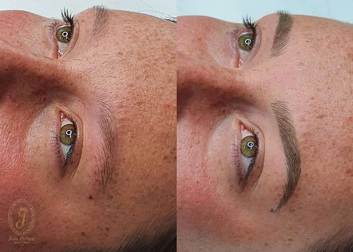 میکروبلیدینگ ابرو 4 تفاوت میکروبلیدینگ با دیگر پر کننده های ابرو در چیست؟