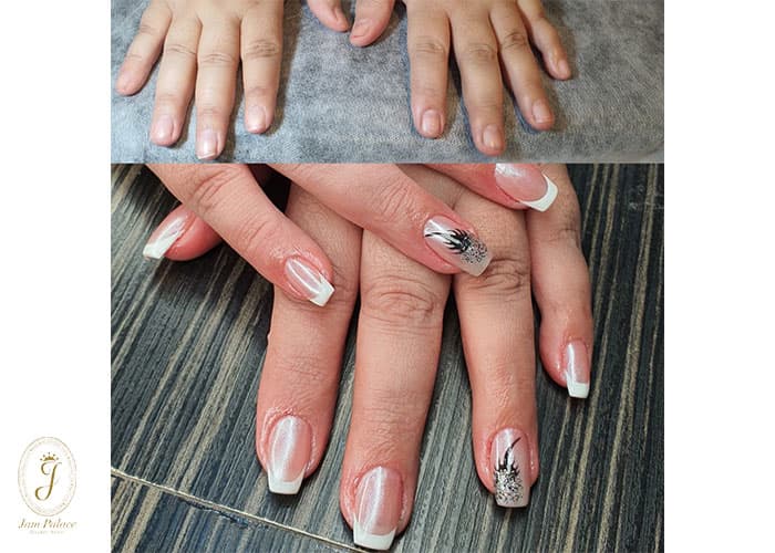 مزایا، معایب و خطرات کاشت ناخن 