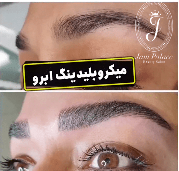 انجام حرفه ای میکروبلیدینگ در نیاوران 4 مراقبت های قبل و بعد از انجام میکروبلیدینگ