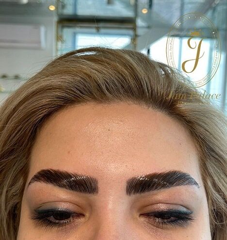 ماندگاری لیفت ابرو تا چه مدت است؟