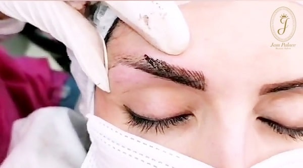 ریموو تتو قدیمی 5 مراقبت ها پس از پاک کردن تاتو قدیمی ابرو